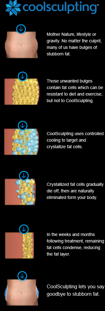 How CoolSculpting Works | CoolSculpting Near Me