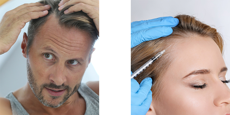 Exosome Hair Therapy: EX-H Shot | Arizona Aesthetics